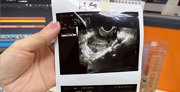 Hospital Ultrasound Paper